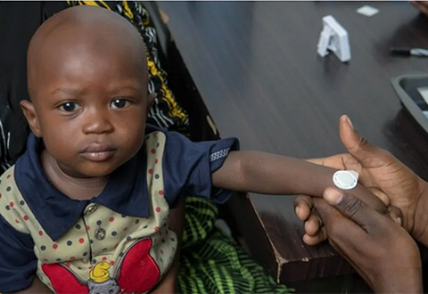 A vaccine patch is placed on the wrist of a child in The Gambia.